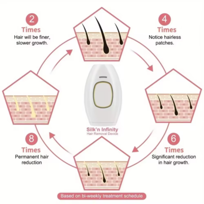 S877725d701284a4dafcbea17820e56add IPL Laser Hair Removal Device for Women